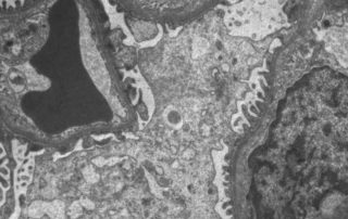 Biological thin section: LVEM image of a kidney lomerulus microstructure.