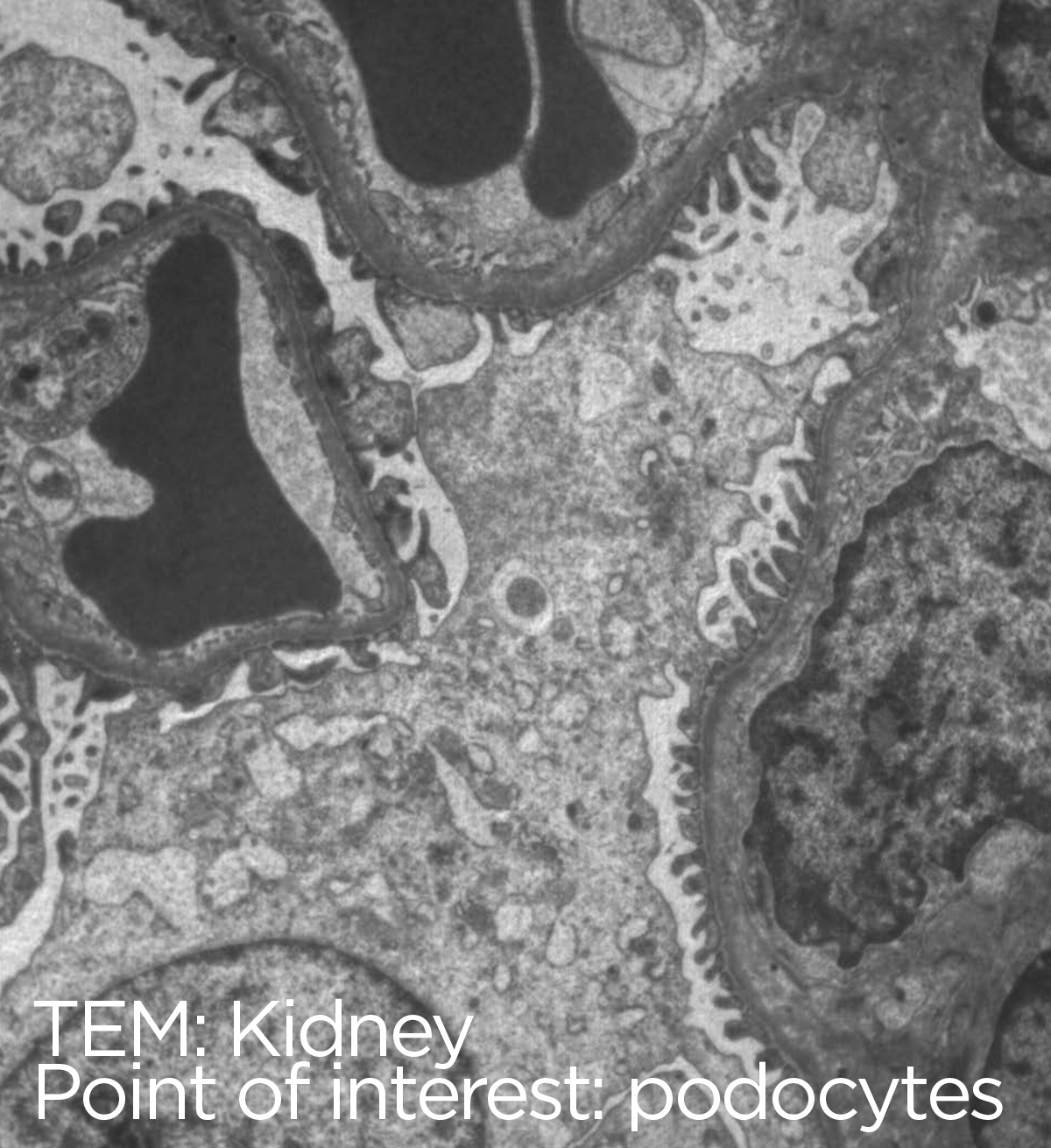 Biological thin section: LVEM image of a kidney lomerulus microstructure.